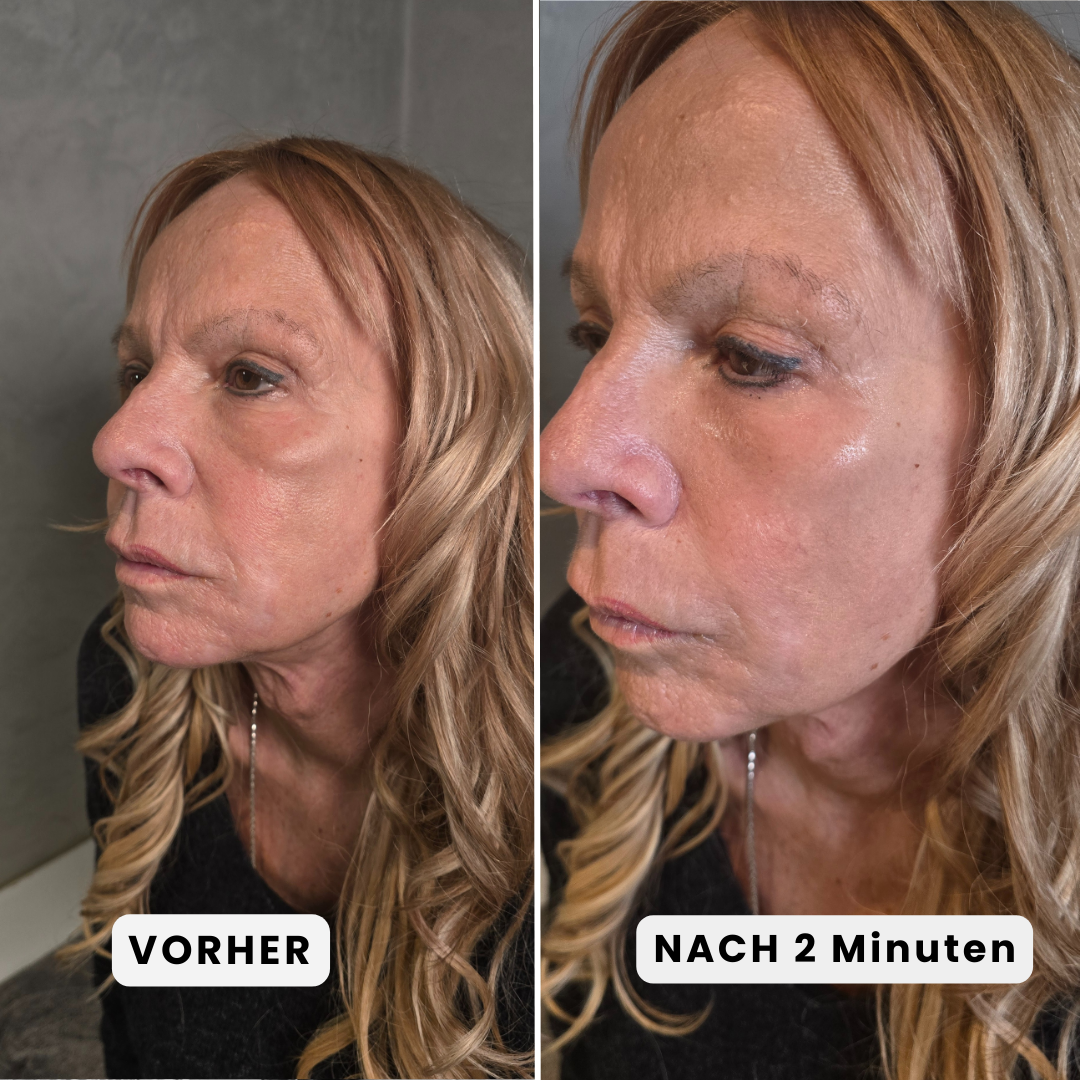 InstantLift™  – Reduziert Falten in nur 2 Minuten.